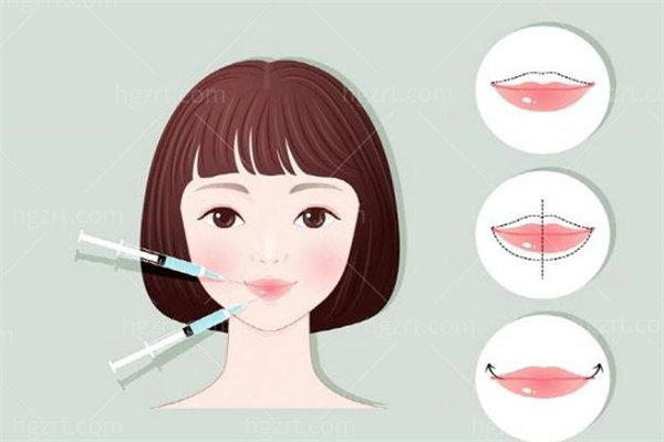 丰唇4.jpg