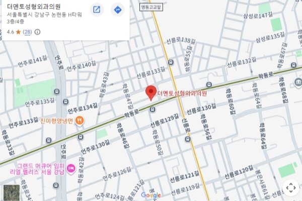 首尔做双眼皮哪家好