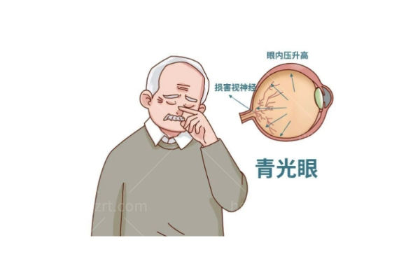 青光眼是视力小偷,早期没症状