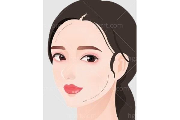 “轮廓固定”真的能打造高级脸吗?揭秘玻尿酸深层支撑的3个关键逻辑