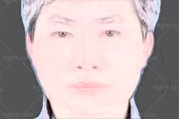 合肥诗蔓医疗美容门诊部徐海燕医生简介
