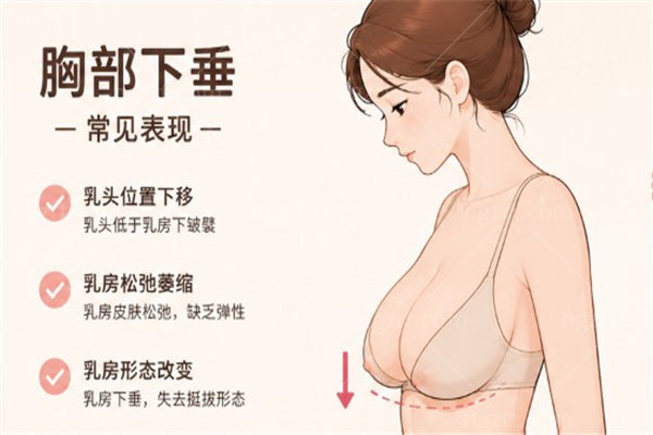 胸部下垂只做隆胸有用吗?乳房提升术和假体隆胸的区别