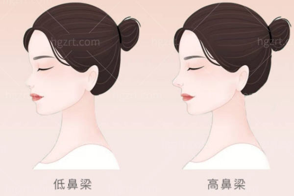 冯雁平做鼻子自然吗?妈生感贼强审美技术超级在线