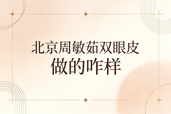 北京周敏茹双眼皮做的咋样？失败眼都能救回来，修复技术真的太牛了！