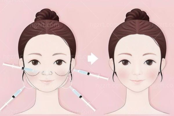 上海汇壹美张本军和吴芝沅修复馒化哪个更好?对比之下发现都蛮好