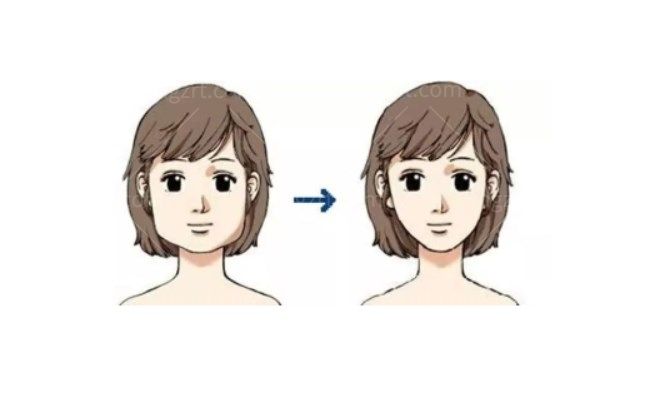 面部吸脂和瘦脸针哪个更适合你?拯救大饼脸看这篇