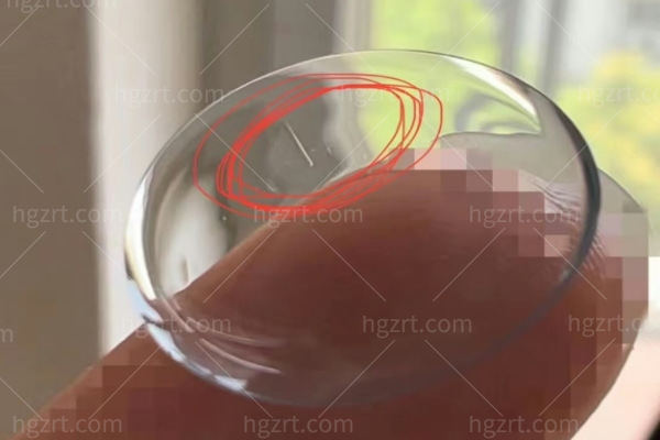 隐形眼镜戴不对,角膜在“窒息”!这5个错误90%的人都在犯