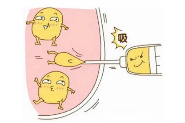 抽脂后皮肤会松吗?怎么避免凹凸不平？