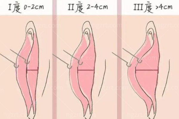 私密保养按摩怎么做