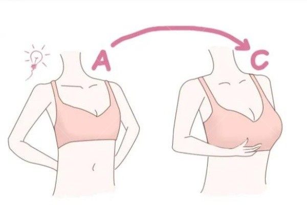 做了乳晕缩小手术后会反弹吗？