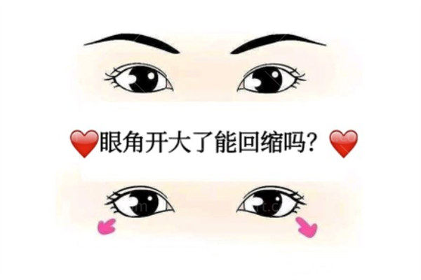 杭州开眼角哪家医院做的好