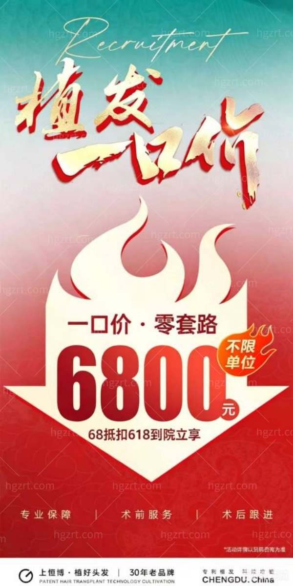 成都植发价格是多少