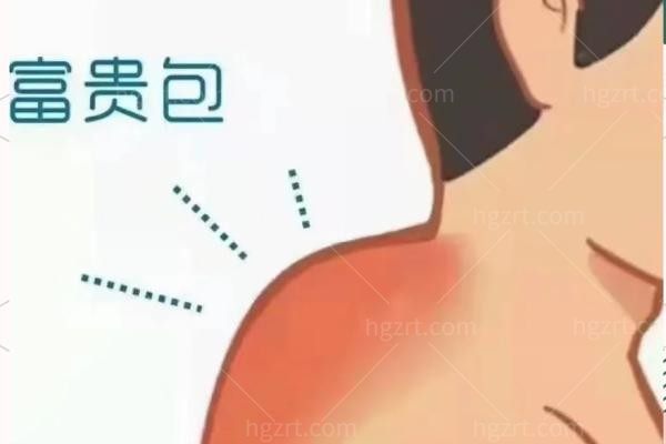 富贵包天天揉真的会变小吗？