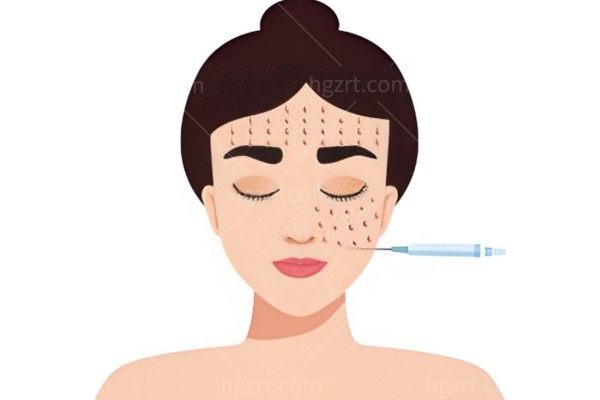 瘦脸针打三次之后,咬肌会永久变小吗？
