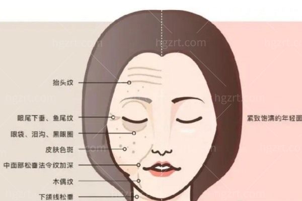 面部衰老层次示意图
