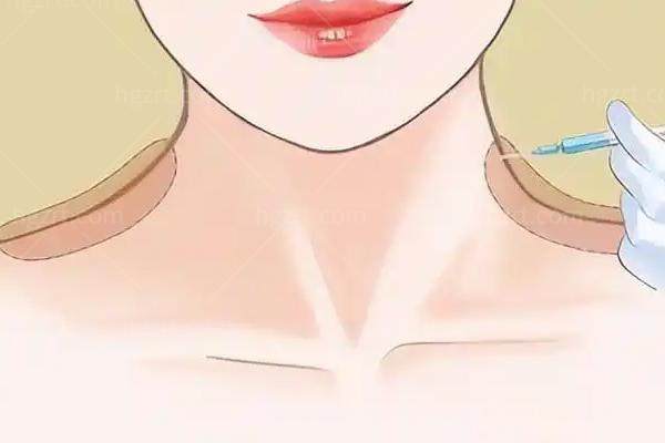 面部抗衰项目科普配图