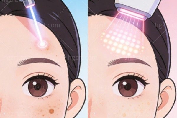 眼窝凹陷是什么原因造成的？