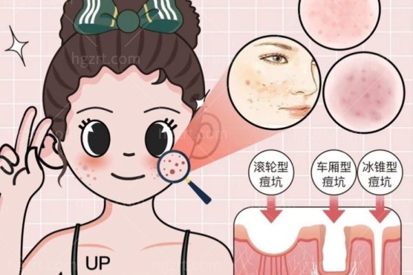 香港水光价格玻尿酸价格