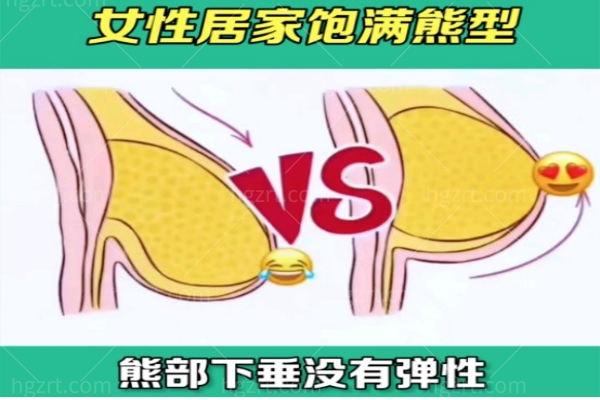 胸部下垂只做隆胸有用吗