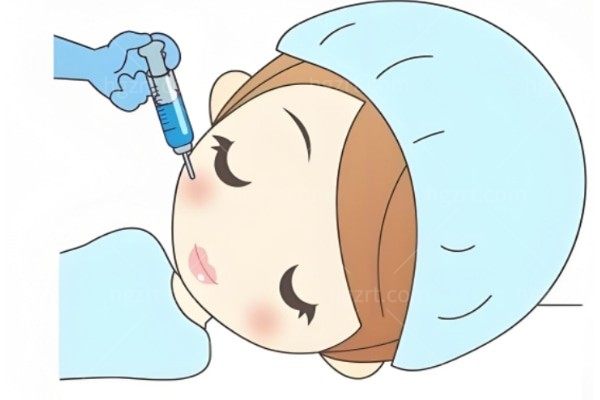瘦脸针打三次就能定型吗？