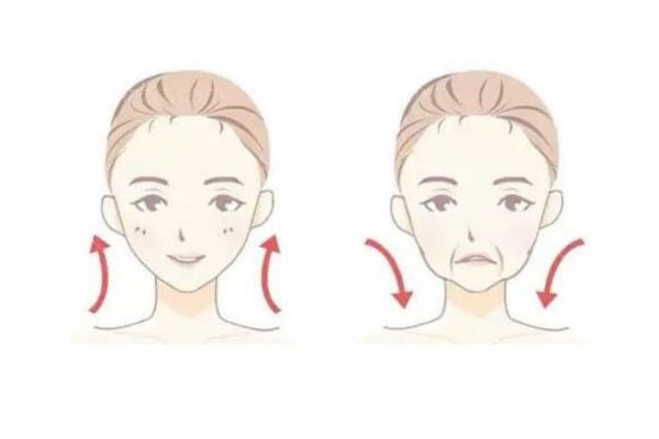 苹果肌填充参考图