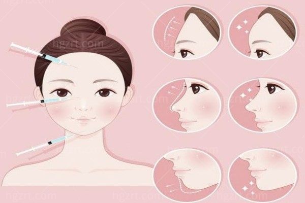 “少女针”和“童颜针”到底是什么?和玻尿酸有什么区别？