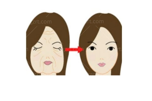 少女针、童颜针和玻尿酸怎么选？别被再生医美四个字带跑