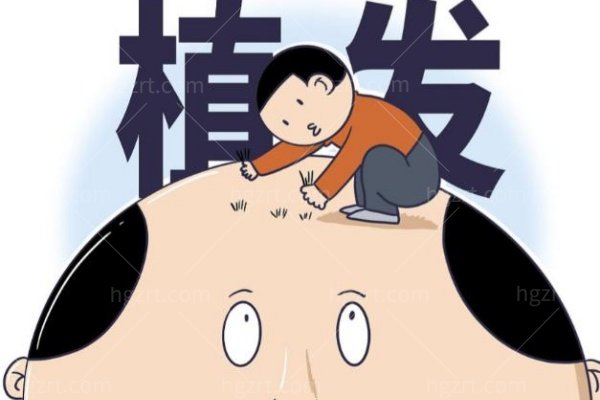 FUE和微针植发技术哪个好？取发孔/种发方向/毛囊生长稳定性四维对比，发际线设计避坑必看
