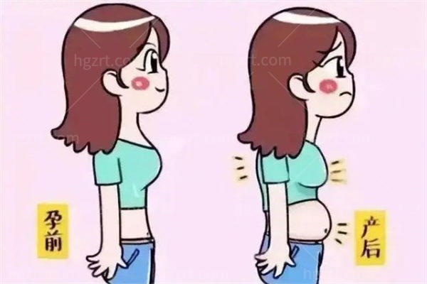 西安刘宾做腹壁整形怎么样?宝妈关心的医生背景、适合人群和价格一次讲清