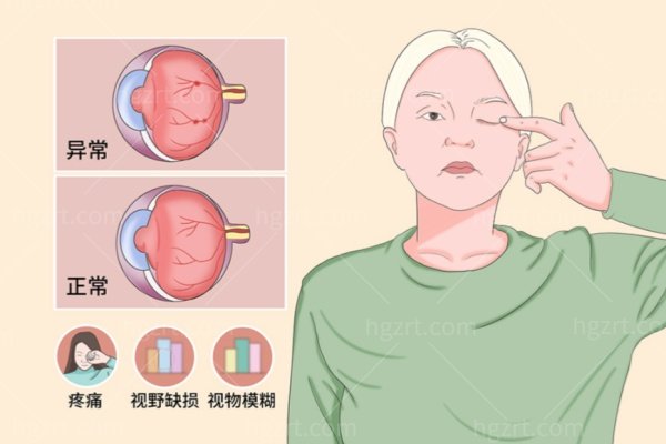 眼科视力检查科普配图