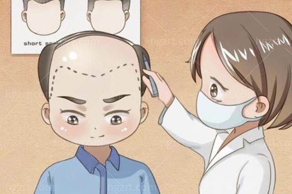 发际线后移除了植发，有没有能让绒毛长出来的生发项目？