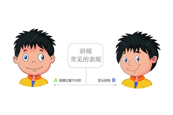 斜视眼位评估科普图