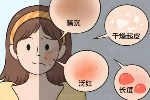 换季过敏泛红脱皮，是皮肤生病了还是正常反应？暂停所有功效产品先做这几步