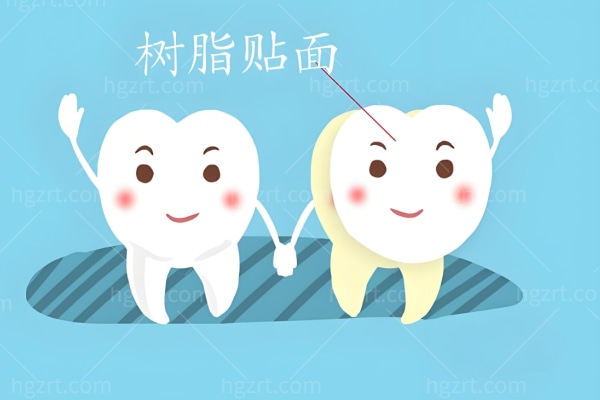 树脂贴面与瓷贴面概念示意图