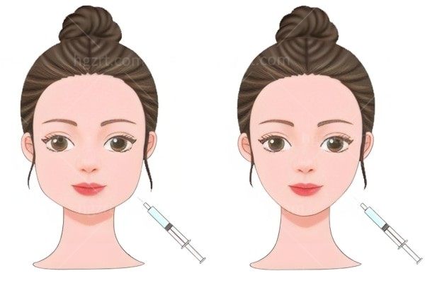 基础款和差别在哪？成分浓度、改善方向、疗程频率一文理清