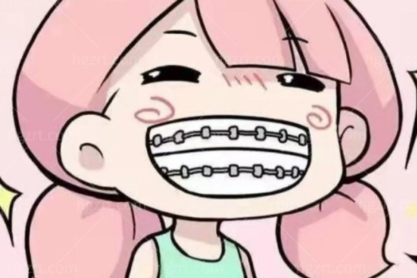 南京德福口腔看牙要提前预约吗？无假日接诊、CT检查和种牙排诊时间这样安排