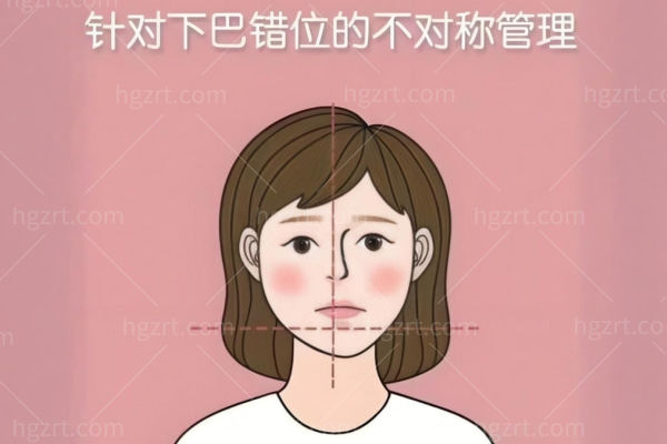 菱形脸微调别一上来就填太阳穴：蒋铮铮、李健、高俊明三种轮廓思路怎么对号